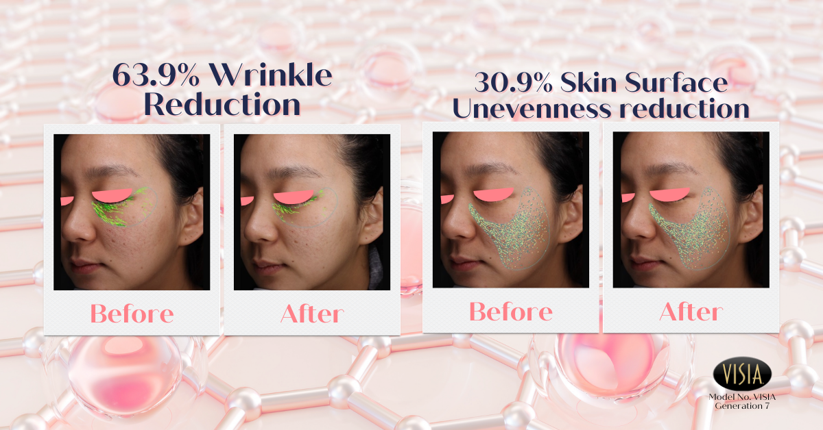 Ribeskin: Betterfill Collagen Shooter (3ml x 4ea)